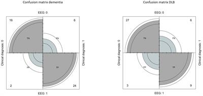 Quantitative EEG for early differential diagnosis of dementia with Lewy bodies